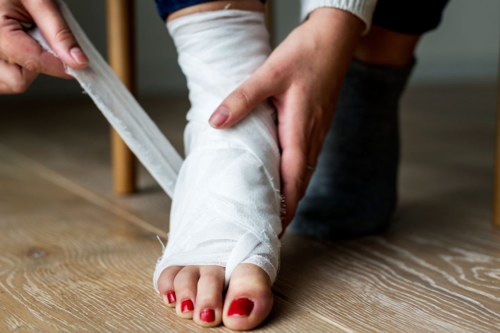Foot fracture with bandage.