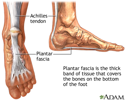 plantar fasciitis anatomy