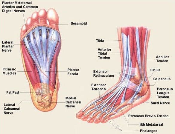 plantar fasciitis