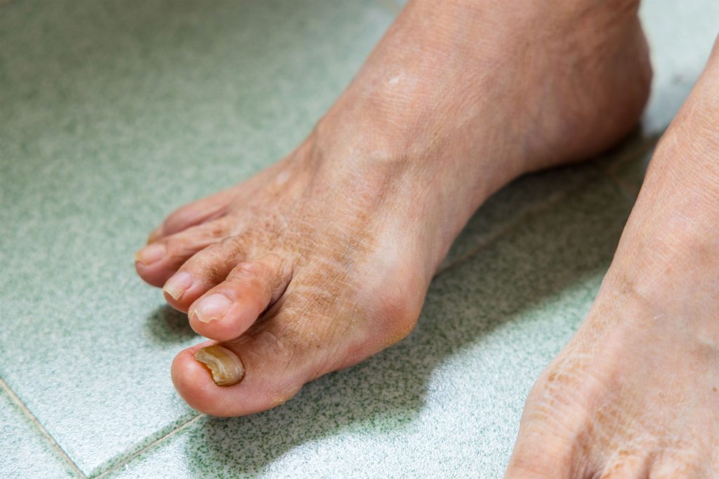 Feet of a person.
