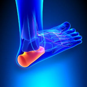 treatments for heel pain and what are the cause