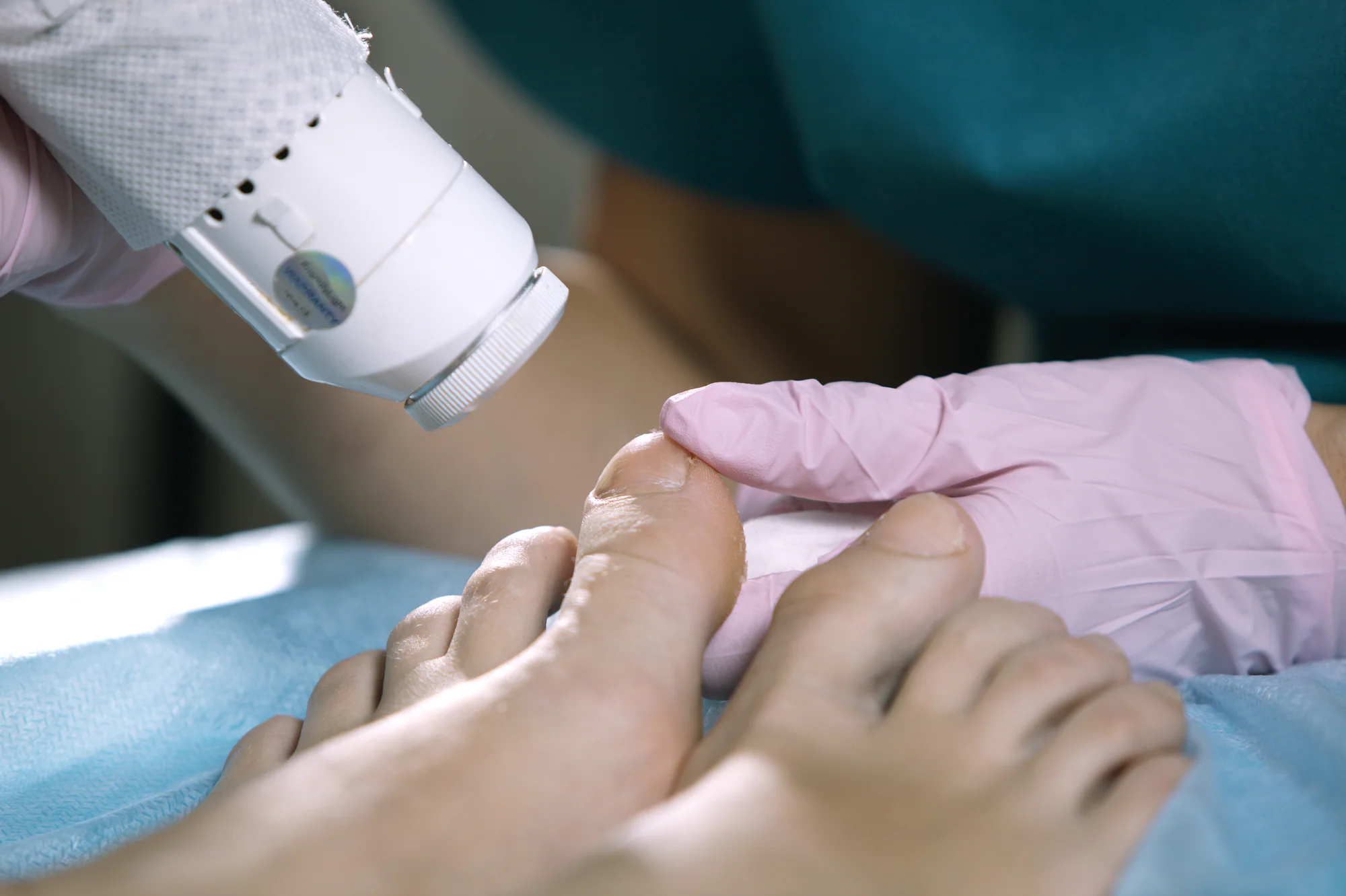 Podiatrist treating a patient's toenail with specialized equipment